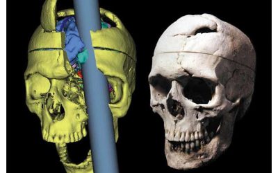 Przypadek Phineasa Gage’a - przełom w medycynie